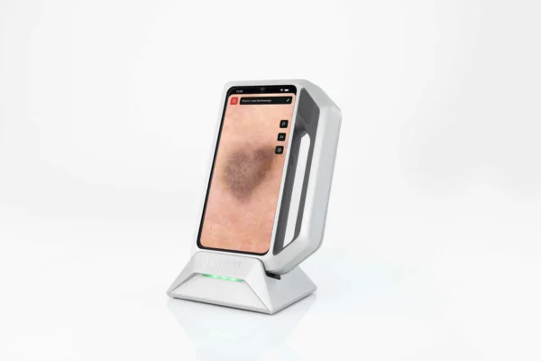 SKEEN – Advanced Imaging for Trichoscopy and Skin Lesion Assessment