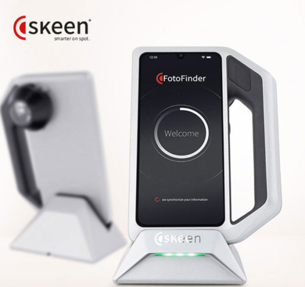 SKEEN – Advanced Imaging for Trichoscopy and Skin Lesion Assessment