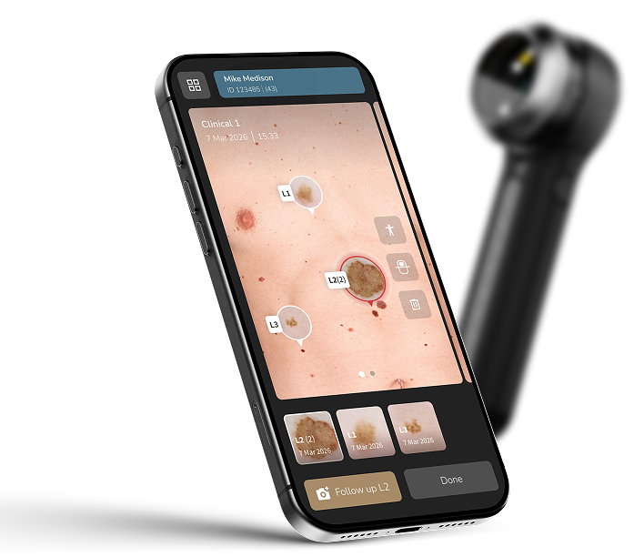 DermLite DL5 Plus - Image 2