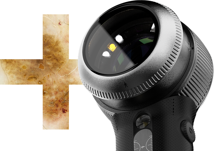 DermLite DL5 Plus - Image 3